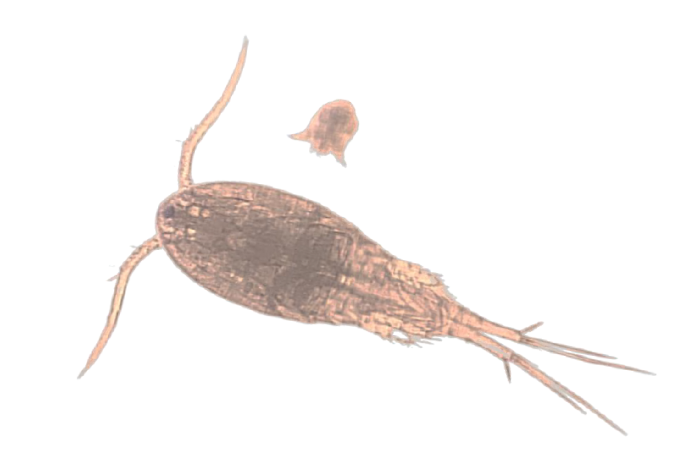 Guinea Worm Disease